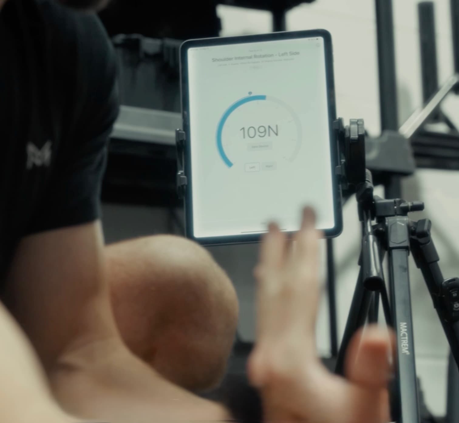 Precision Arm Care at MMPT